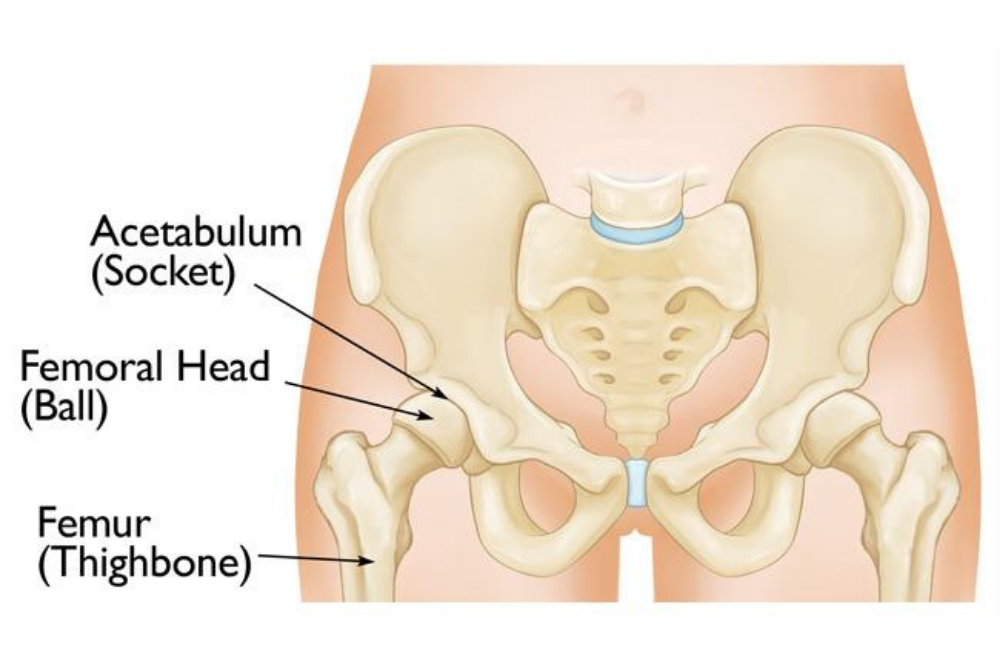 Pelviacetabular Fracture